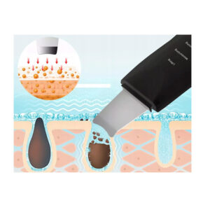 Συσκευή Απολέπισης και Καθαρισμού Προσώπου με Υπερήχους Verk Group 5907451332825 - Image 4