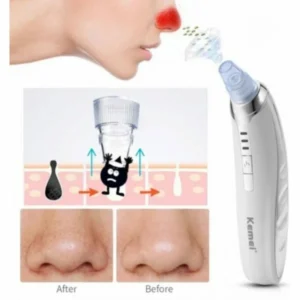 Συσκευή για βαθύ καθαρισμό προσώπου - KM-1868 - Kemei - Image 18